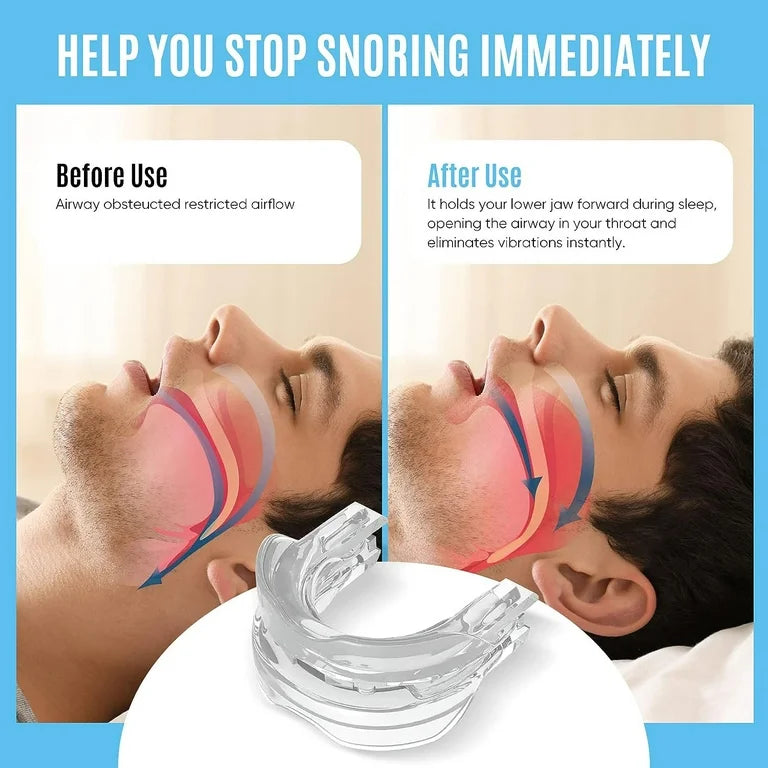 Anti Snoring Device Zquiet